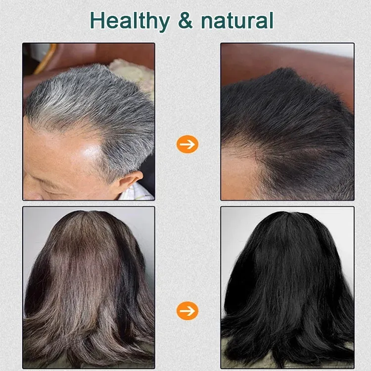 Natural Plant Hair Dye BUY 5 GET 5 FREE(10 bags)